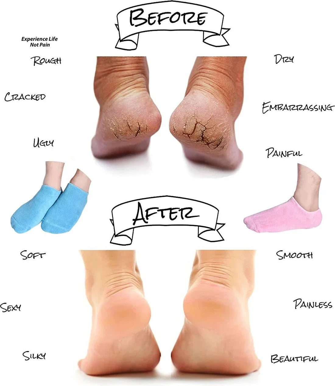 Spa gel socks (Anti Slip & Ease care for foot)