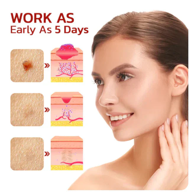 Wipe Off Tags and Mole Remover Pen